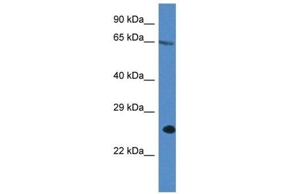 anti-Inositol 1,4,5-Trisphosphate Receptor Interacting Protein (ITPRIP) (C-Term) antibody