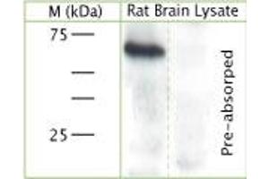 Image no. 2 for anti-Synapsin II (SYN2) (AA 410-460) antibody (ABIN350889)
