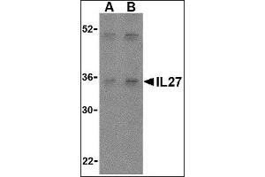Image no. 2 for anti-Interleukin-27 Subunit alpha (IL27) (Center) antibody (ABIN372920)