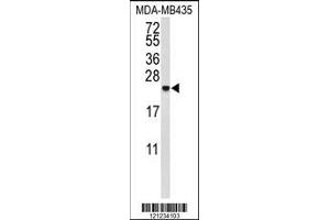 Image no. 1 for anti-Interleukin 10 (IL10) (AA 27-53) antibody (ABIN653057)