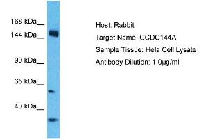 Host: Rabbit Target Name: CCDC144A Sample Type: Hela Whole cell lysates Antibody Dilution: 1.