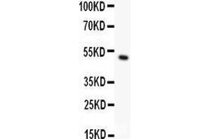 anti-Ribosomal Protein S6 Kinase, 90kDa, Polypeptide 5 (RPS6KA5) (AA 540-665) antibody