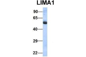 Image no. 3 for anti-LIM Domain and Actin Binding 1 (LIMA1) (N-Term) antibody (ABIN2776038)