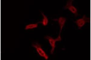 Image no. 8 for anti-PTK2 Protein tyrosine Kinase 2 (PTK2) (pTyr397) antibody (ABIN6256730)