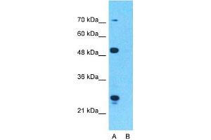 Image no. 6 for anti-Carnitine Palmitoyltransferase 1A (Liver) (CPT1A) (Middle Region) antibody (ABIN2782010)