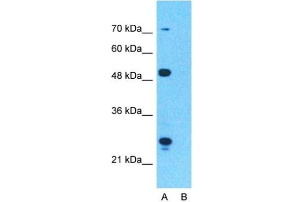 CPT1A antibody  (Middle Region)