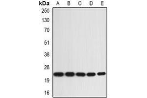 Image no. 1 for anti-Interleukin 1 Family, Member 6 (IL1F6) (full length) antibody (ABIN6043596)