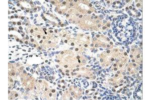 Image no. 1 for anti-Ring Finger Protein 14 (RNF14) (C-Term) antibody (ABIN203171)