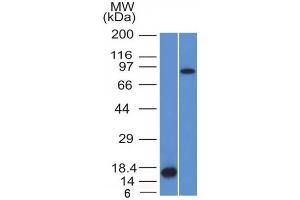 Image no. 1 for anti-Coagulation Factor XIII, A1 Polypeptide (F13A1) (AA 46-181) antibody (ABIN6939361)