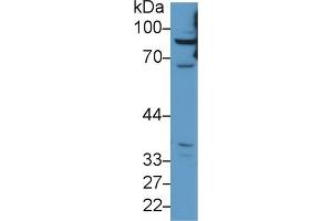 CPT1A antibody  (AA 191-353)