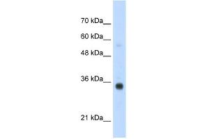 Image no. 1 for anti-Homeobox B4 (HOXB4) (N-Term) antibody (ABIN2781201)