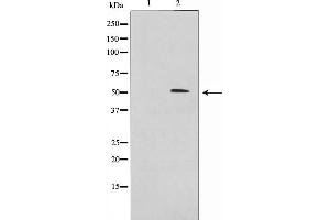 Image no. 1 for anti-Iroquois Homeobox Protein 2 (IRX2) antibody (ABIN6262670)