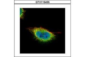 Image no. 3 for anti-Glucocorticoid Modulatory Element Binding Protein 1 (GMEB1) (AA 315-573) antibody (ABIN1501891)
