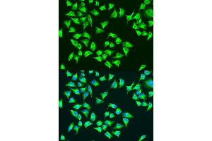 Image no. 2 for anti-Mitochondrially Encoded ATP Synthase 6 (MT-ATP6) antibody (ABIN6137340)