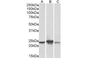 Image no. 1 for anti-Abhydrolase Domain Containing 14B (ABHD14B) (AA 188-200) antibody (ABIN5539776)