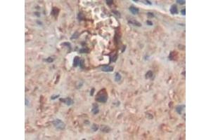 Image no. 2 for anti-Cartilage Oligomeric Matrix Protein (COMP) (AA 235-423) antibody (ABIN1858467)