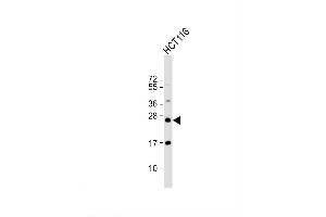 Image no. 4 for anti-RAB8A, Member RAS Oncogene Family (RAB8A) antibody (ABIN1881723)