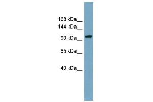 Image no. 1 for anti-Elongator Acetyltransferase Complex Subunit 2 (ELP2) (Middle Region) antibody (ABIN2787102)