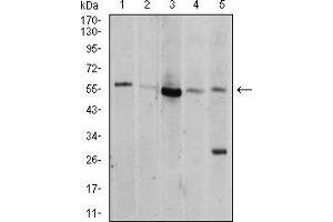 Image no. 4 for anti-V-Akt Murine Thymoma Viral Oncogene Homolog 1 (AKT1) (AA 1-150) antibody (ABIN5542263)