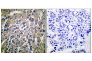 Image no. 3 for anti-HCG beta (C-Term) antibody (ABIN1848592)