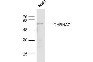 Image no. 2 for anti-Cholinergic Receptor, Nicotinic, alpha 7 (Neuronal) (CHRNA7) (AA 441-502) antibody (ABIN736911)