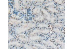 Image no. 3 for anti-Fibrillarin (FBL) (AA 85-274) antibody (ABIN5013544)