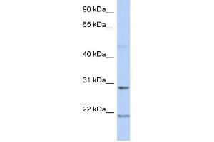 Image no. 1 for anti-Chromosome 12 Open Reading Frame 53 (C12orf53) (Middle Region) antibody (ABIN636113)
