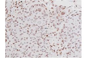 Image no. 2 for anti-Mast/stem Cell Growth Factor Receptor (KIT) (pTyr721) antibody (ABIN6256004)