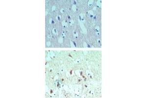 Image no. 1 for anti-Eukaryotic Translation Initiation Factor 4A2 (EIF4A2) (AA 1-50) antibody (ABIN960157)