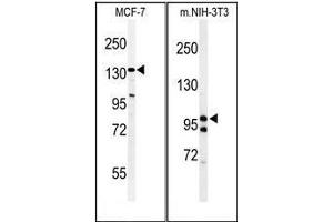 Image no. 3 for anti-TAF2 RNA Polymerase II, TATA Box Binding Protein (TBP)-Associated Factor, 150kDa (TAF2) (AA 1159-1188), (C-Term) antibody (ABIN955066)