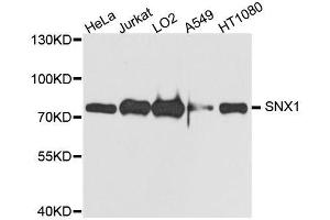 Image no. 1 for anti-Sorting Nexin 1 (SNX1) antibody (ABIN6148234)