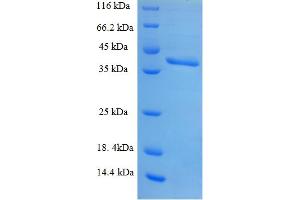 Image no. 1 for Small Nuclear Ribonucleoprotein Polypeptide B (SNRPB2) (AA 1-225), (full length) protein (His-SUMO Tag) (ABIN5711087)