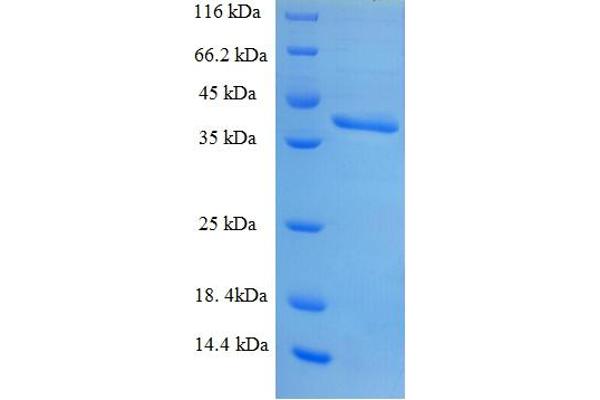 Small Nuclear Ribonucleoprotein Polypeptide B (SNRPB2) (AA 1-225), (full length) protein (His-SUMO Tag)