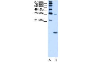 Image no. 2 for anti-Hemoglobin, zeta (HBZ) (N-Term) antibody (ABIN629807)