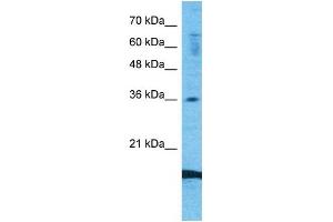 Image no. 4 for anti-Chemokine (C-C Motif) Ligand 18 (Pulmonary and Activation-Regulated) (CCL18) (Middle Region) antibody (ABIN2792202)