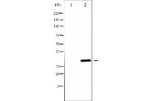 Image no. 1 for anti-Cyclin D3 (CCND3) (pThr283) antibody (ABIN6255654)