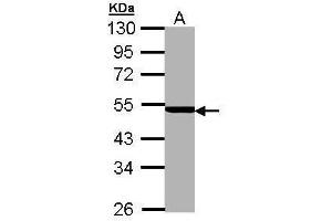 Image no. 2 for anti-Proteasome (Prosome, Macropain) 26S Subunit, ATPase, 3 (PSMC3) (Center) antibody (ABIN2856692)