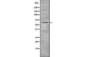 Image no. 1 for anti-Cytochrome P450, Family 4, Subfamily F, Polypeptide 22 (CYP4F22) antibody (ABIN6261204)