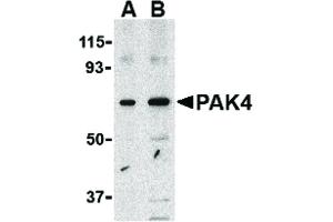 Image no. 1 for anti-P21-Activated Kinase 4 (PAK4) (Internal Region) antibody (ABIN6655350)