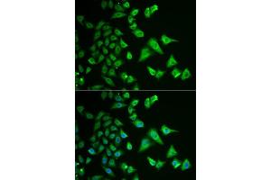 Image no. 4 for anti-Dehydrogenase/reductase (SDR Family) Member 2 (DHRS2) antibody (ABIN6139594)