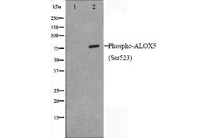 Image no. 2 for anti-Arachidonate 5-Lipoxygenase (ALOX5) (pSer523) antibody (ABIN6255395)