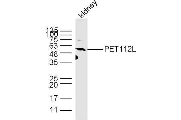 PET112L 抗体  (AA 101-200)