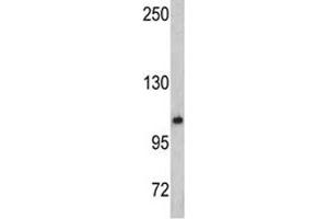 Image no. 2 for anti-O-Linked N-Acetylglucosamine (GlcNAc) Transferase (UDP-N-Acetylglucosamine:polypeptide-N-Acetylglucosaminyl Transferase) (OGT) (AA 1017-1046) antibody (ABIN3032083)