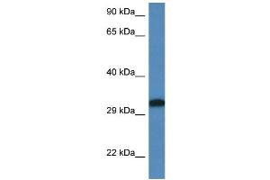 Image no. 1 for anti-Distal-Less Homeobox 6 (DLX6) (C-Term) antibody (ABIN2776435)