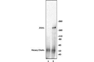 Image no. 2 for anti-Zinc Finger E-Box Binding Homeobox 1 (ZEB1) (N-Term) antibody (ABIN6972920)