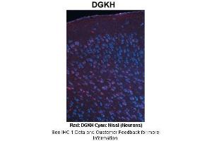 Image no. 2 for anti-Diacylglycerol Kinase, eta (DGKH) (Middle Region) antibody (ABIN2782346)