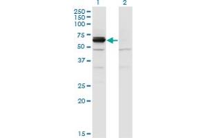 Image no. 3 for anti-Dihydropyrimidinase-Like 4 (DPYSL4) (AA 461-559) antibody (ABIN523995)