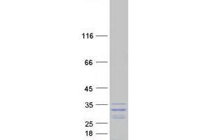 Image no. 1 for GAR1 Ribonucleoprotein Homolog (Yeast) (GAR1) (Transcript Variant 1) protein (Myc-DYKDDDDK Tag) (ABIN2727449)