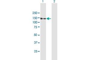 Image no. 1 for anti-Zinc Finger, FYVE Domain Containing 16 (ZFYVE16) (AA 1-809) antibody (ABIN523216)