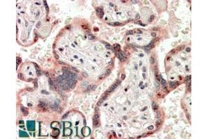 Image no. 1 for anti-Teratocarcinoma-Derived Growth Factor 1 (TDGF1) (Internal Region) antibody (ABIN570931)